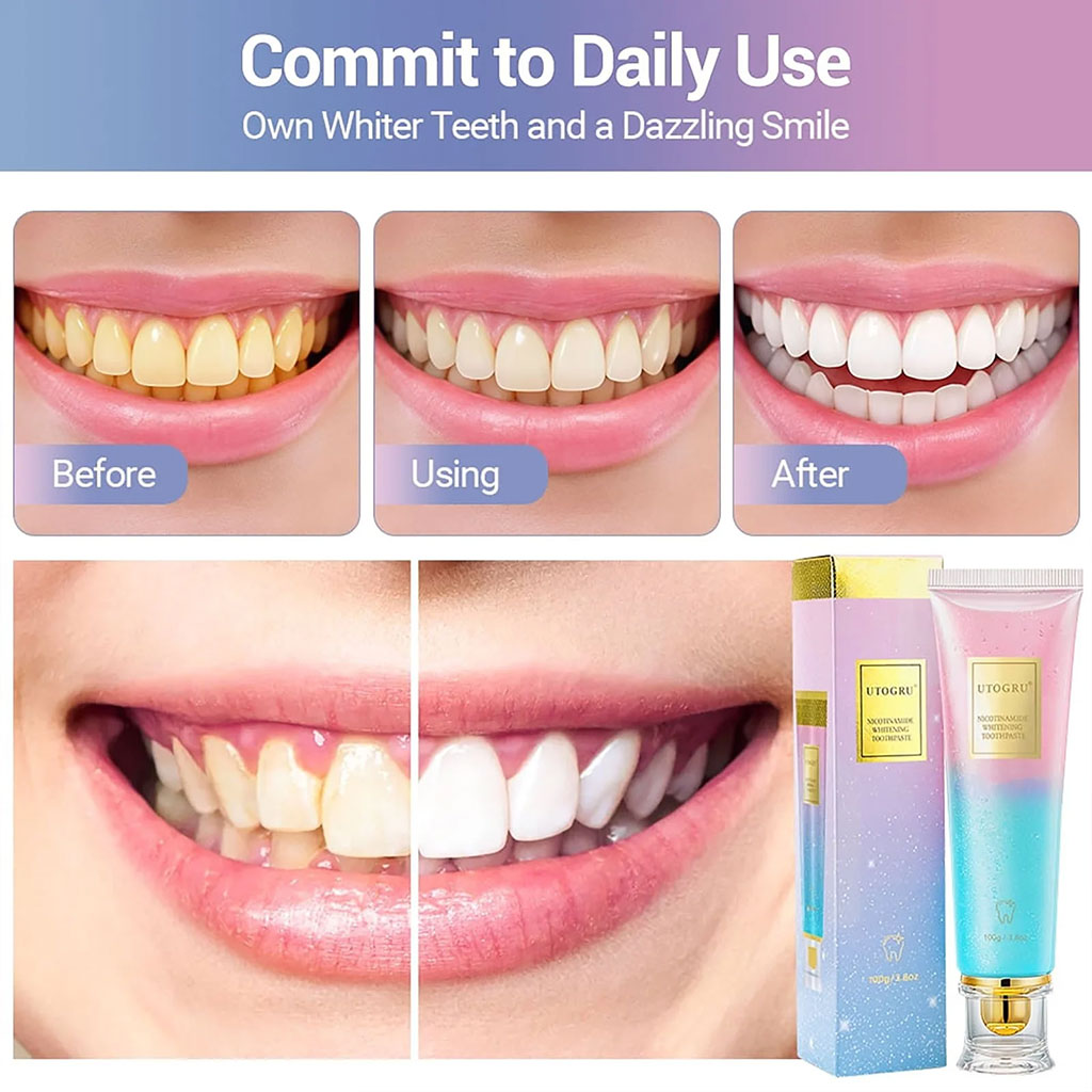 Dentifrice blanchissant à la niacinamide UTOGRU Triple action blanchissante – معجون تبييض الأسنان - Soins et Beauté - صورة 4