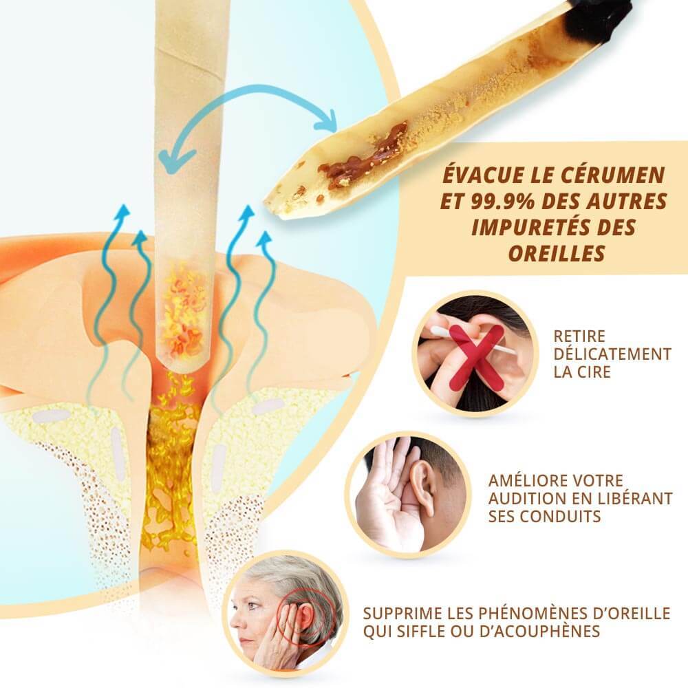 Bougies Auriculaires en Cire Naturelle Pack 20Pcs – شموع الأذن من الشمع الطبيعي - Soins et Beauté - صورة 8
