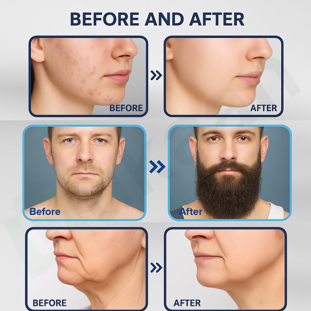 Derma Stamp Professional ديرما ستامب بإبر تيتانيوم قابلة للتعديل 0–3 مم | 140 إبرة للشعر واللحية والبشرة - Soins et Beauté - صورة 10